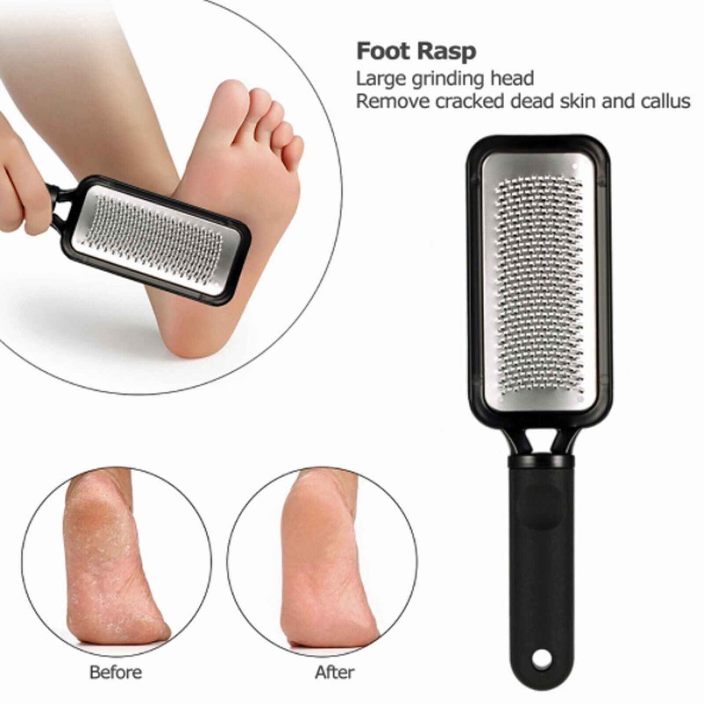 LUPO™ Stainless Steel Foot Scraper Callus Remover