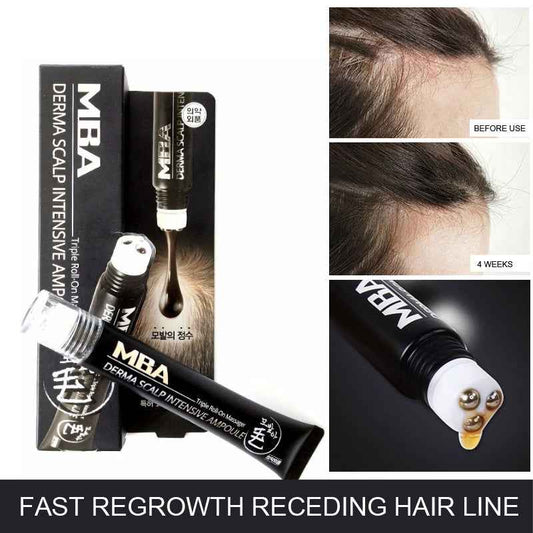 Precision Hairline Growth Fluid – Targeted Hair Regrowth Serum with Massage Applicator