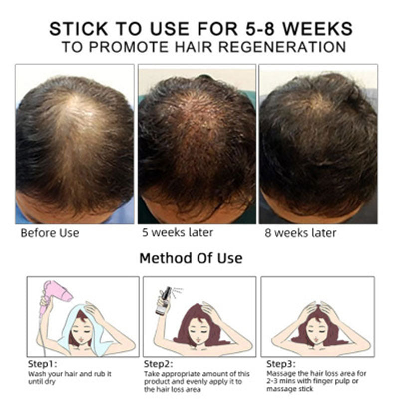 Hair Growth Essential Oil – Strengthen, Soothe & Revitalize