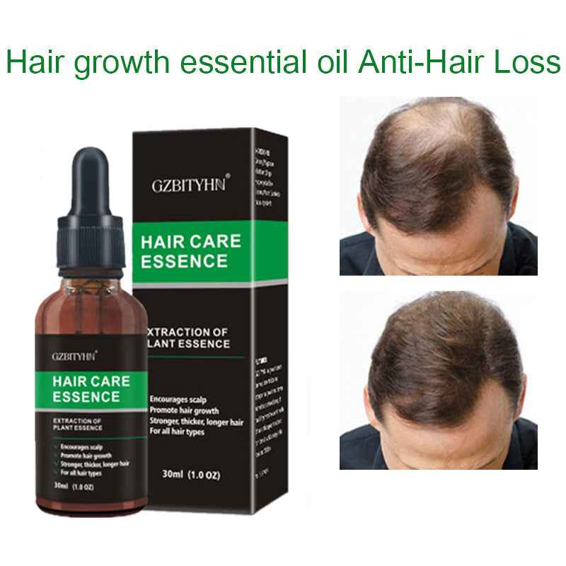 Hair Growth Essential Oil – Strengthen, Soothe & Revitalize