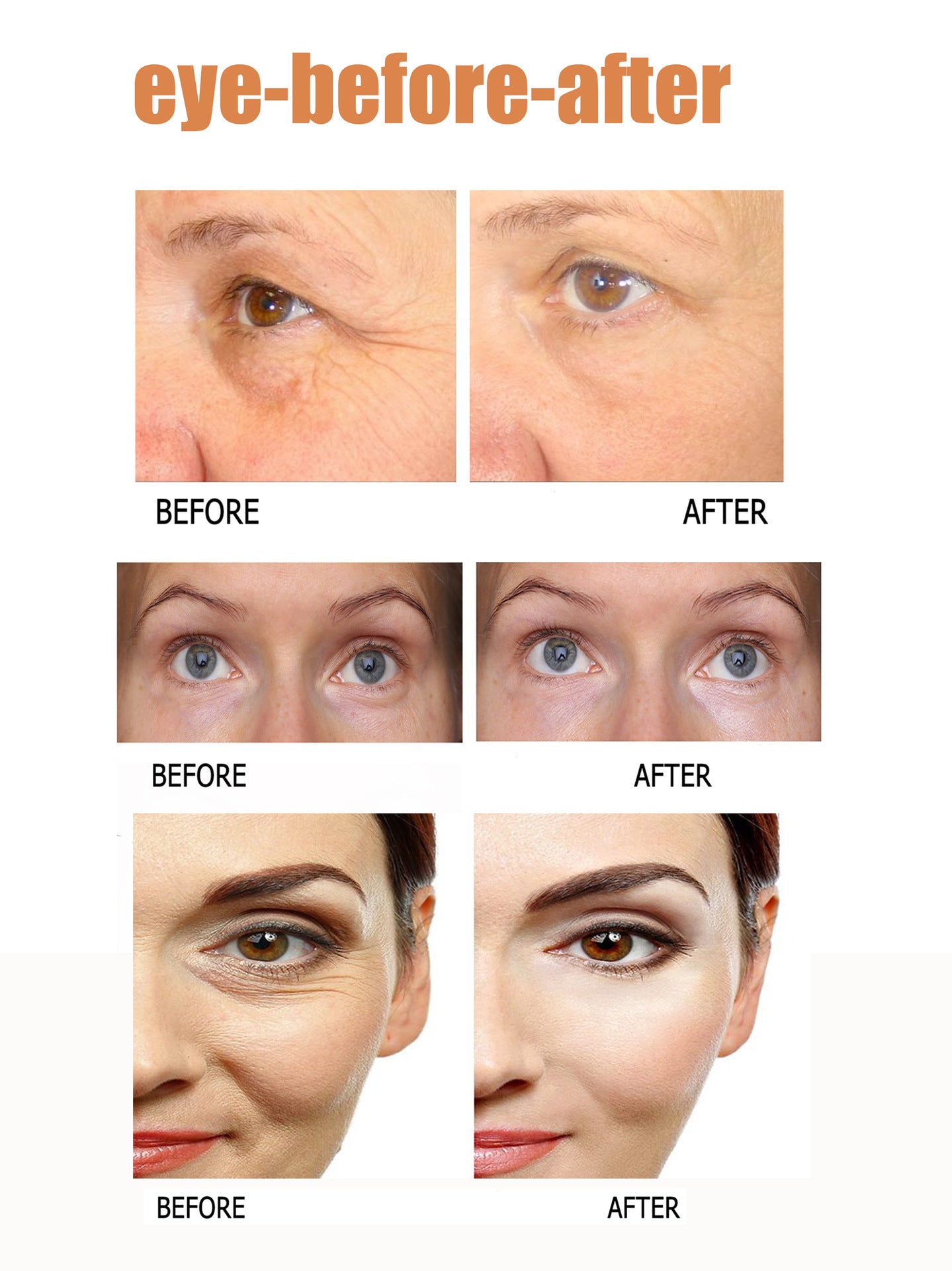 Visuasource Eye Cream – Rapid Eye Bag & Wrinkle Care