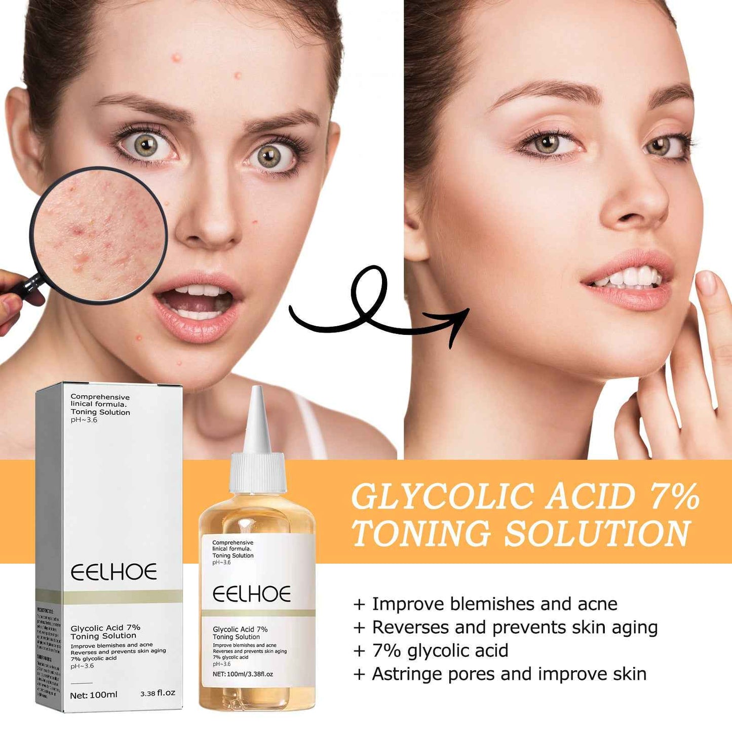 ClearGlow Glycolic Acid 7% Exfoliating Lotion – Acne & Texture Refining Toner (100ml)