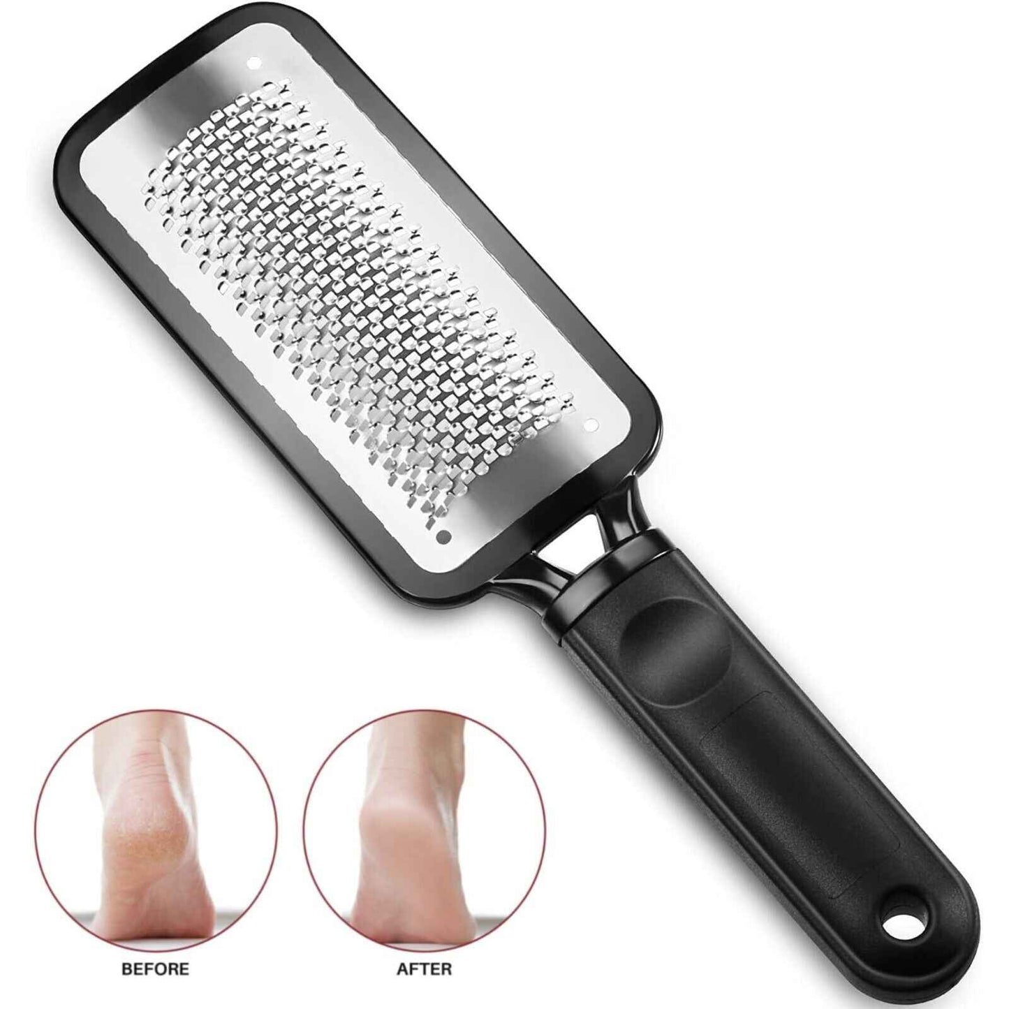 LUPO™ Stainless Steel Foot Scraper Callus Remover