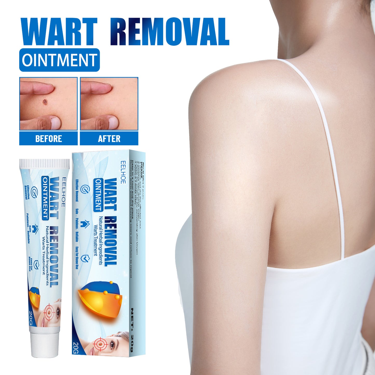 EELHOE Fragrance Removing Cream – Skin Repair & Wart Removal Treatment