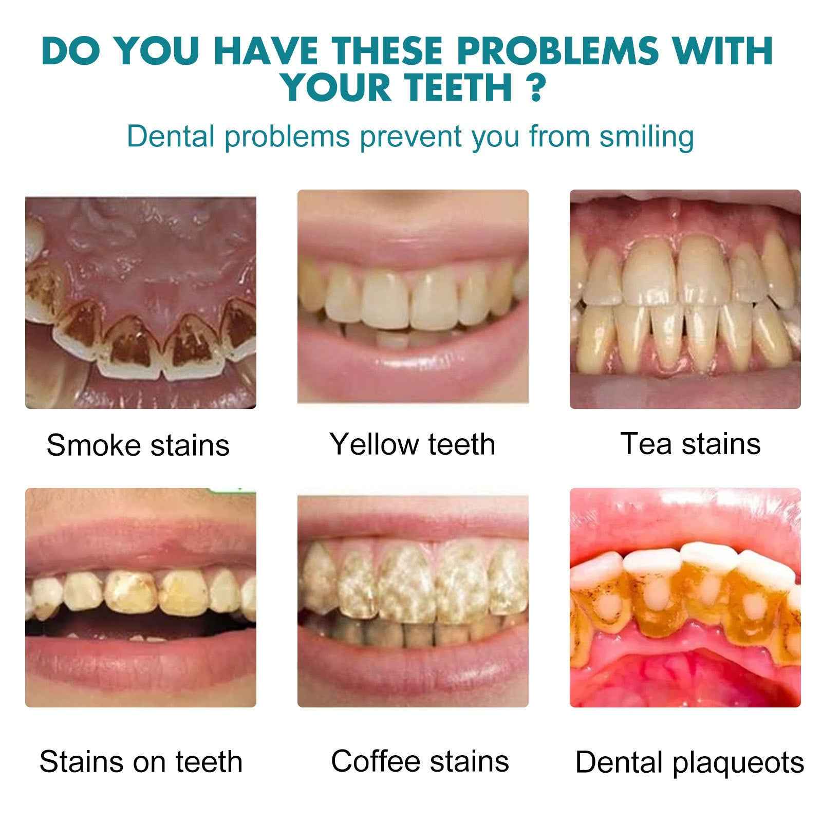 Teeth Cleaning Oral Care Clean