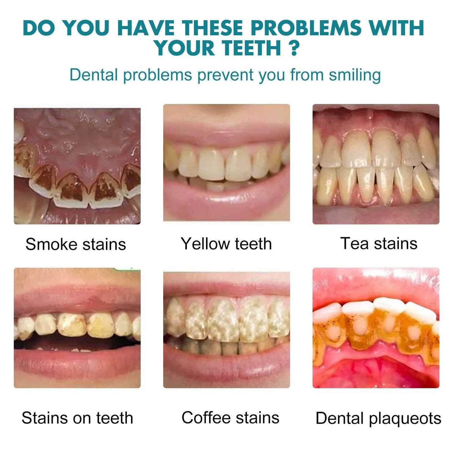 Teeth Cleaning Oral Care Clean