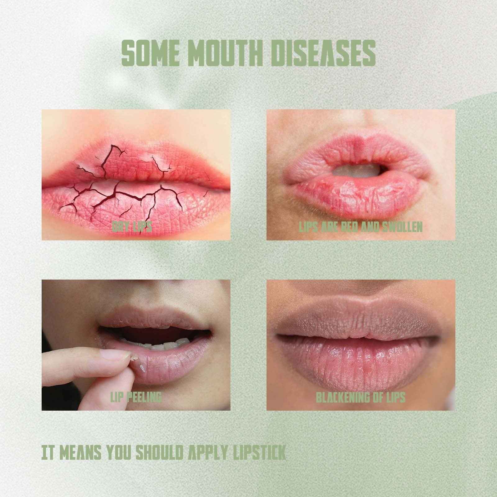 Moisturizing Lip Balm – Anti-Chapping & Nourishing Lip Care