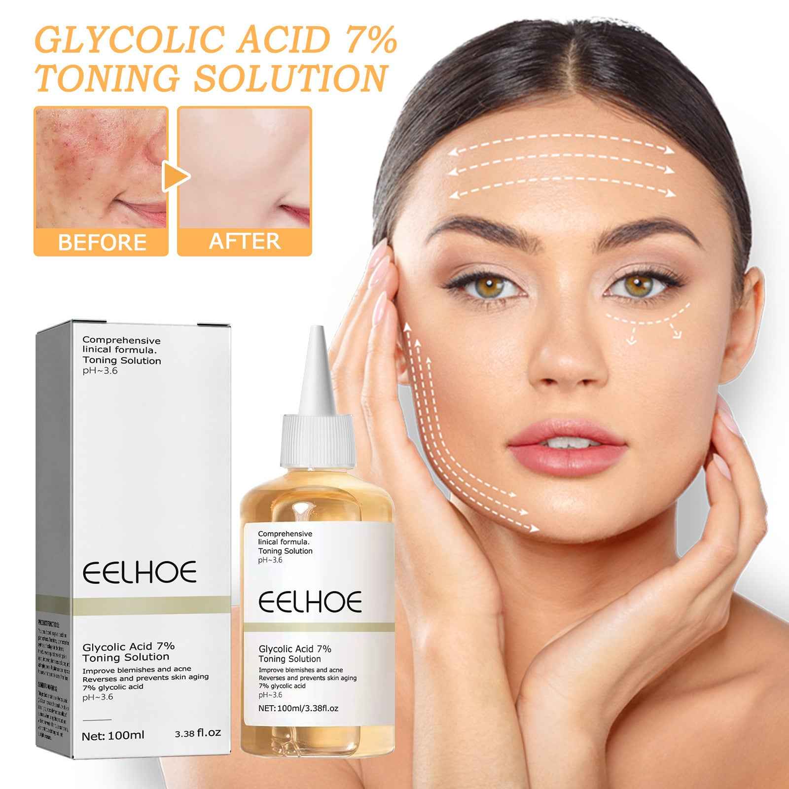 ClearGlow Glycolic Acid 7% Exfoliating Lotion – Acne & Texture Refining Toner (100ml)