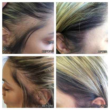Precision Hairline Growth Fluid – Targeted Hair Regrowth Serum with Massage Applicator