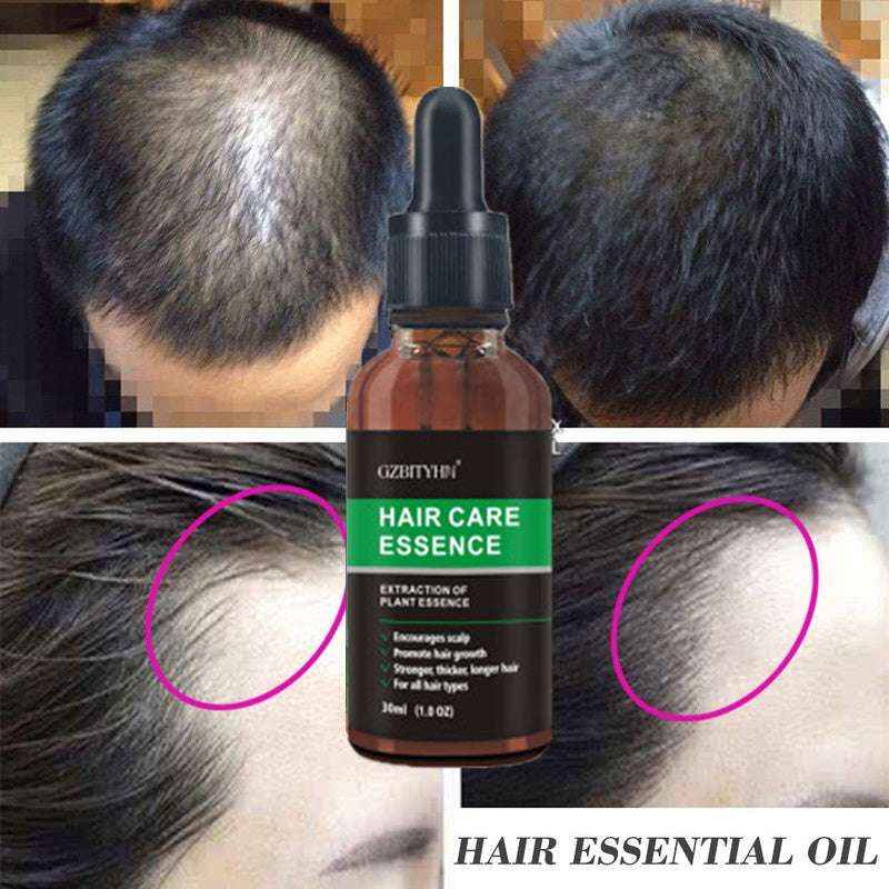 Hair Growth Essential Oil – Strengthen, Soothe & Revitalize