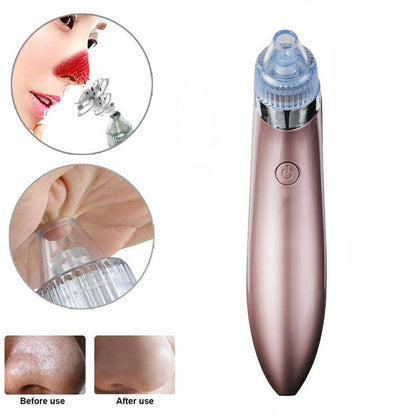 Electric Blackhead Vacuum Pore Cleaner – Deep Facial Cleansing & Skin Rejuvenation Tool