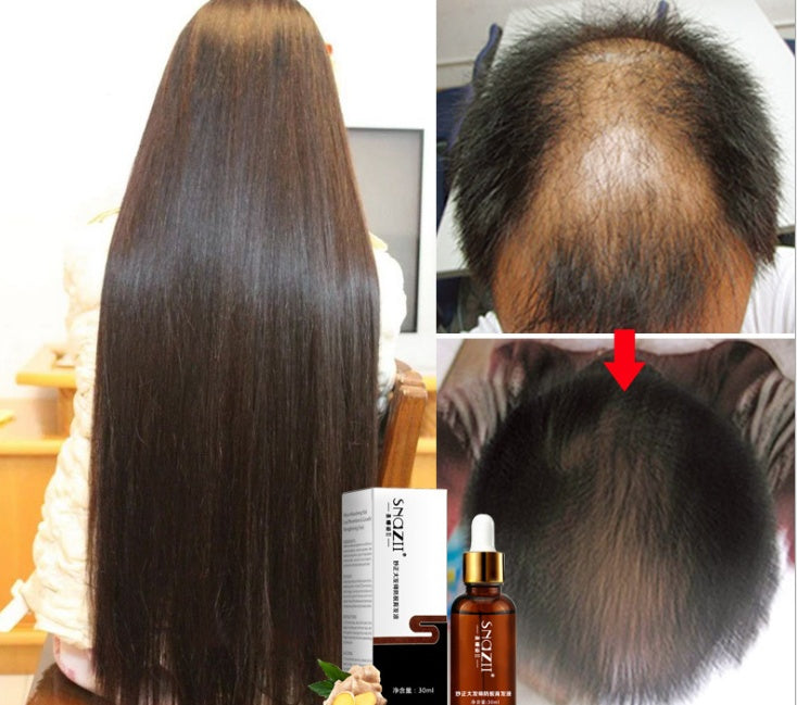 Senna Hair Growth Fluid – 30ml