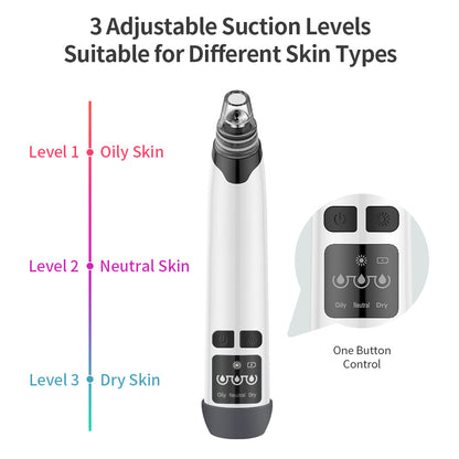 Blackhead Remover Vacuum – Deep Facial Cleansing & Pore Care