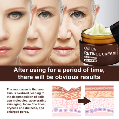 EELHOE Retinol Cream – Anti-Aging, Firming, Brightening & Moisturizing Facial Care