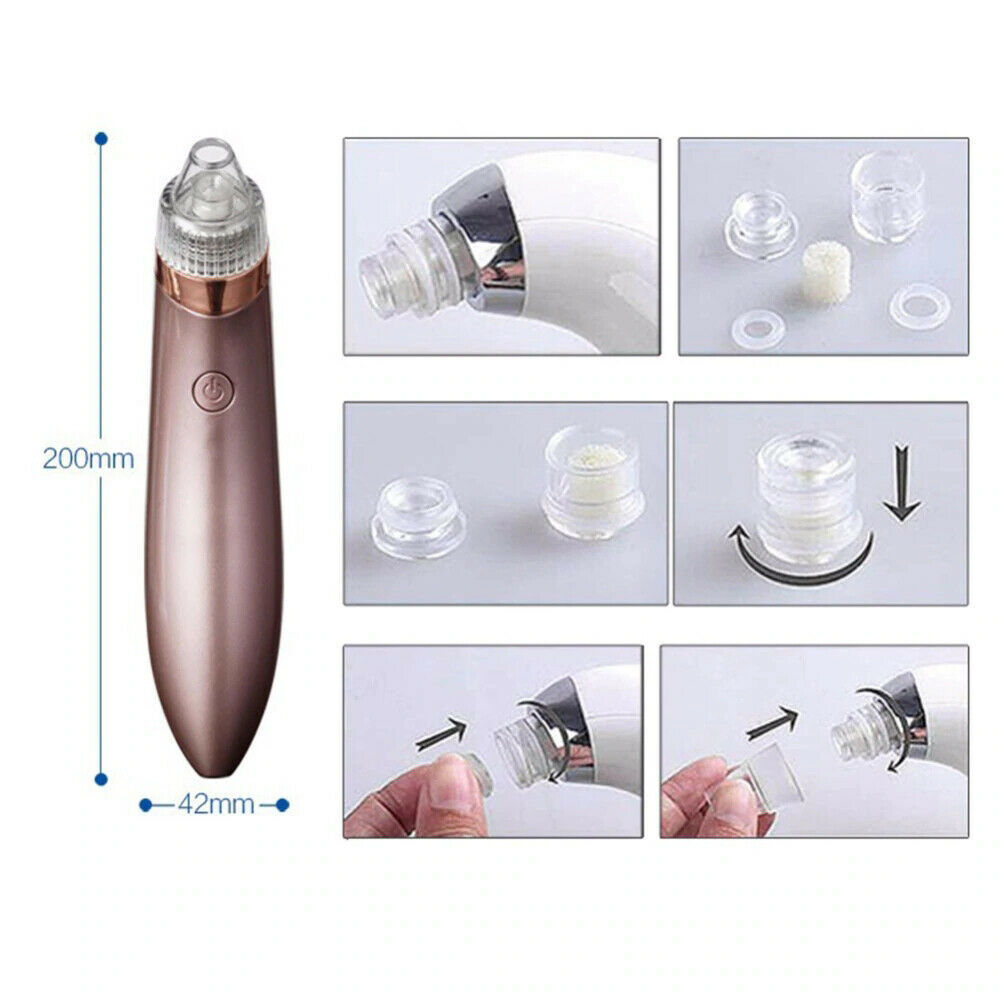 Electric Blackhead Vacuum Pore Cleaner – Deep Facial Cleansing & Skin Rejuvenation Tool