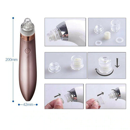 Electric Blackhead Vacuum Pore Cleaner – Deep Facial Cleansing & Skin Rejuvenation Tool