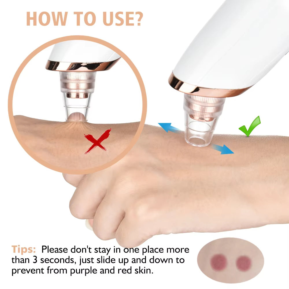 PurePore Pro – Electric Vacuum Blackhead Remover & Facial Cleansing Tool Kit