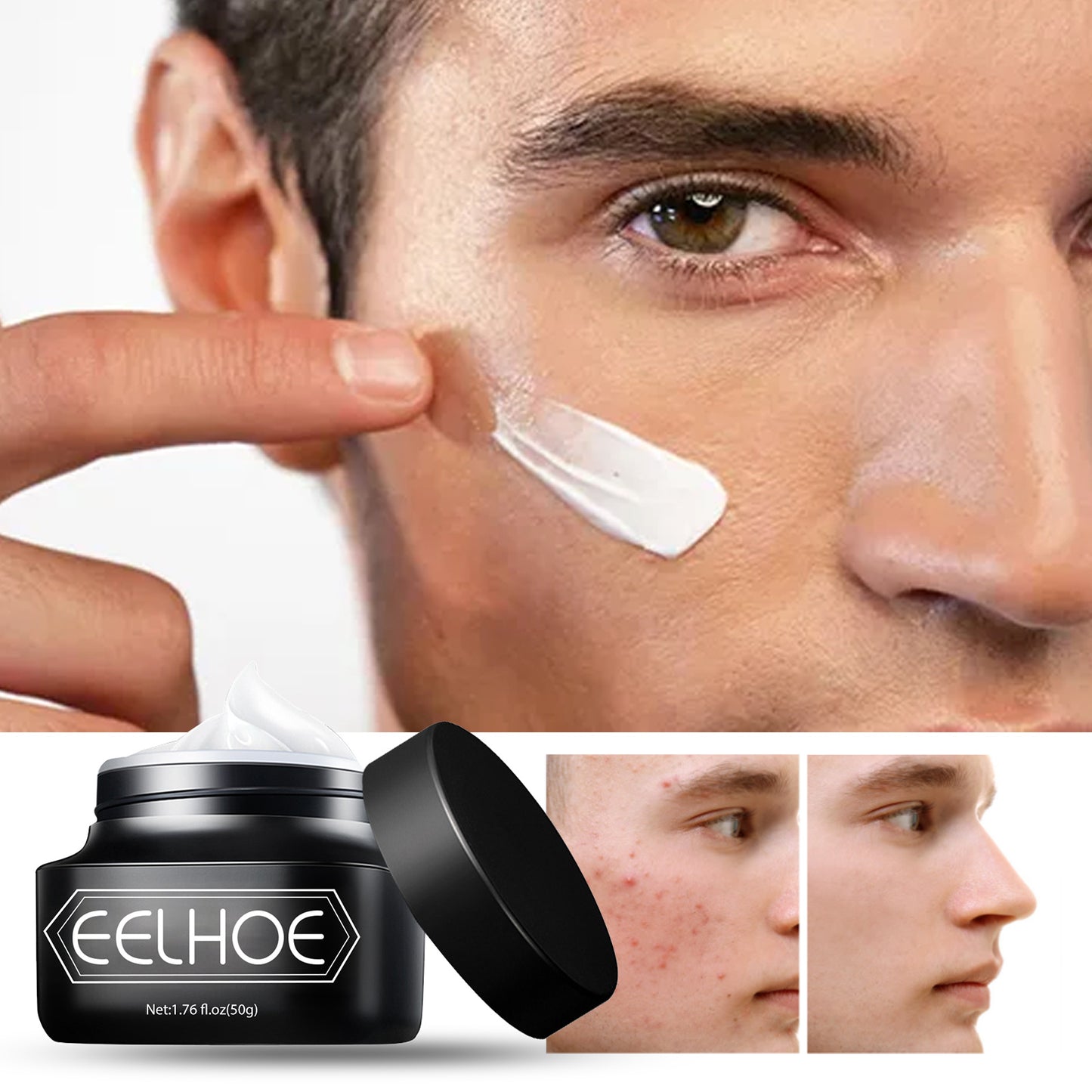 EELHOE Men’s Vegetarian Cream – Non-Greasy Concealer for Acne Marks & Brightened Complexion