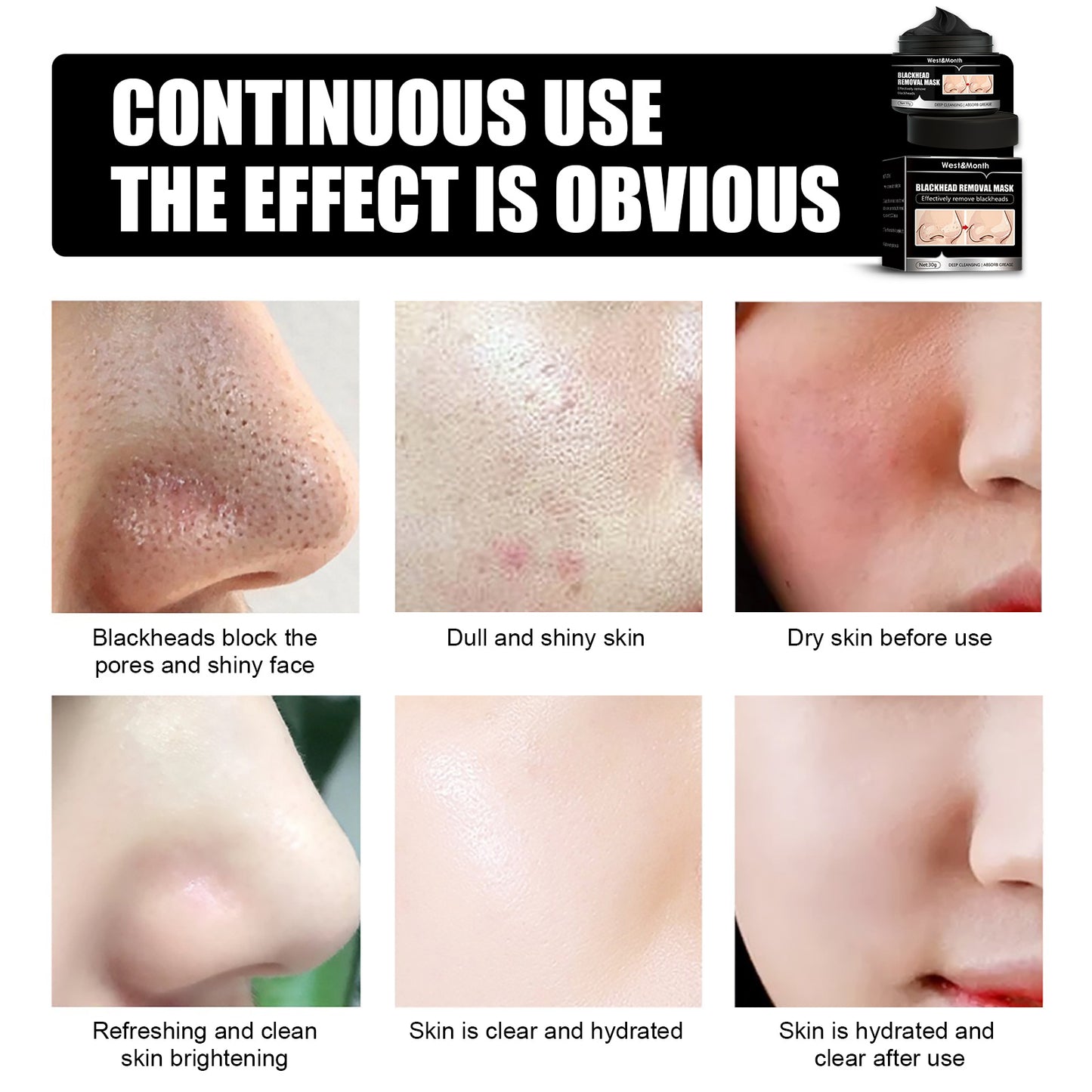 PureGlow™ Charcoal Detox Peel-Off Mask