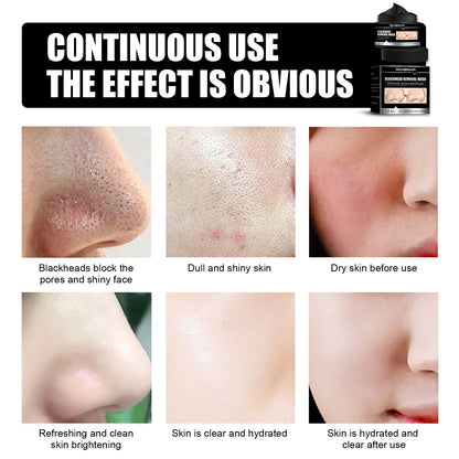 PureGlow™ Charcoal Detox Peel-Off Mask