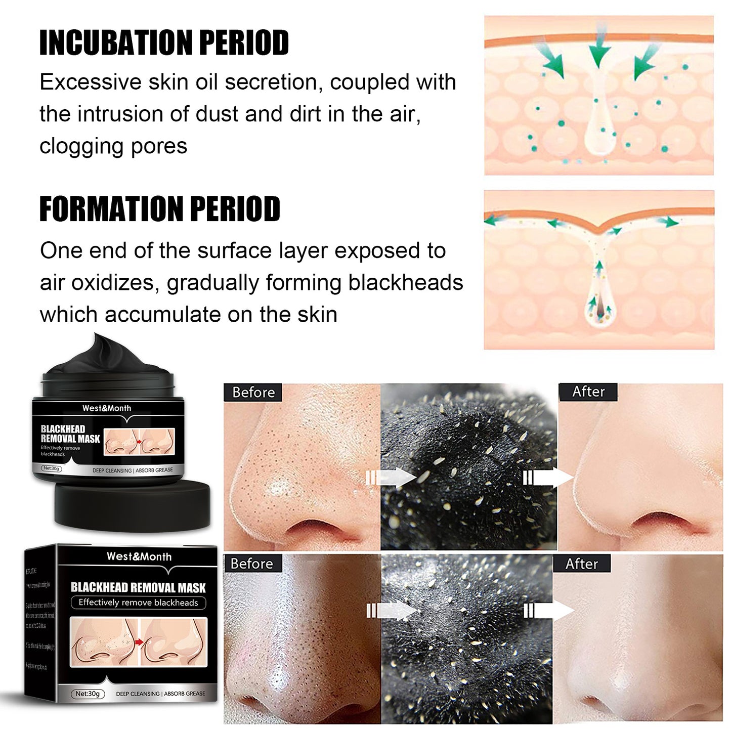 PureGlow™ Charcoal Detox Peel-Off Mask