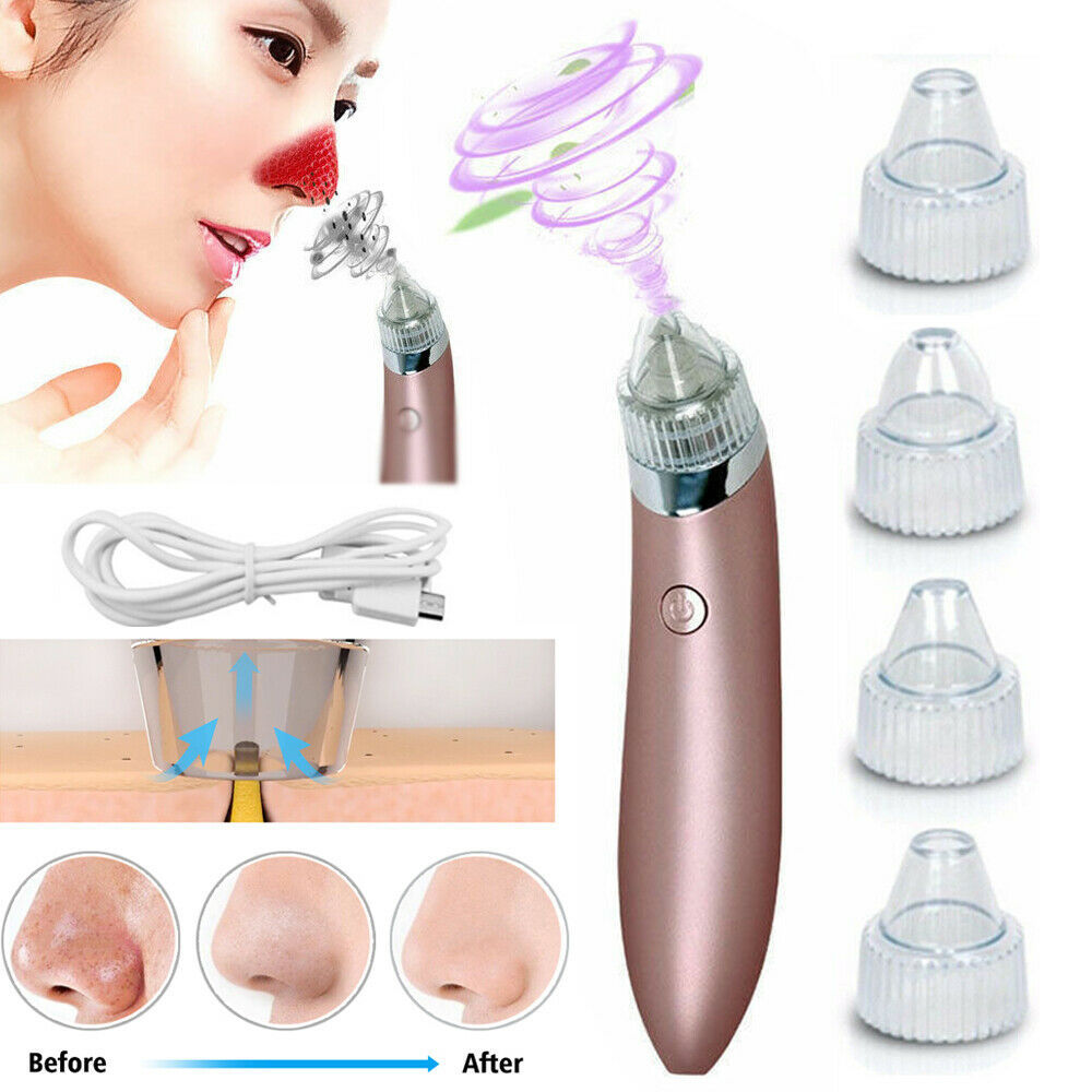 Electric Blackhead Vacuum Pore Cleaner – Deep Facial Cleansing & Skin Rejuvenation Tool