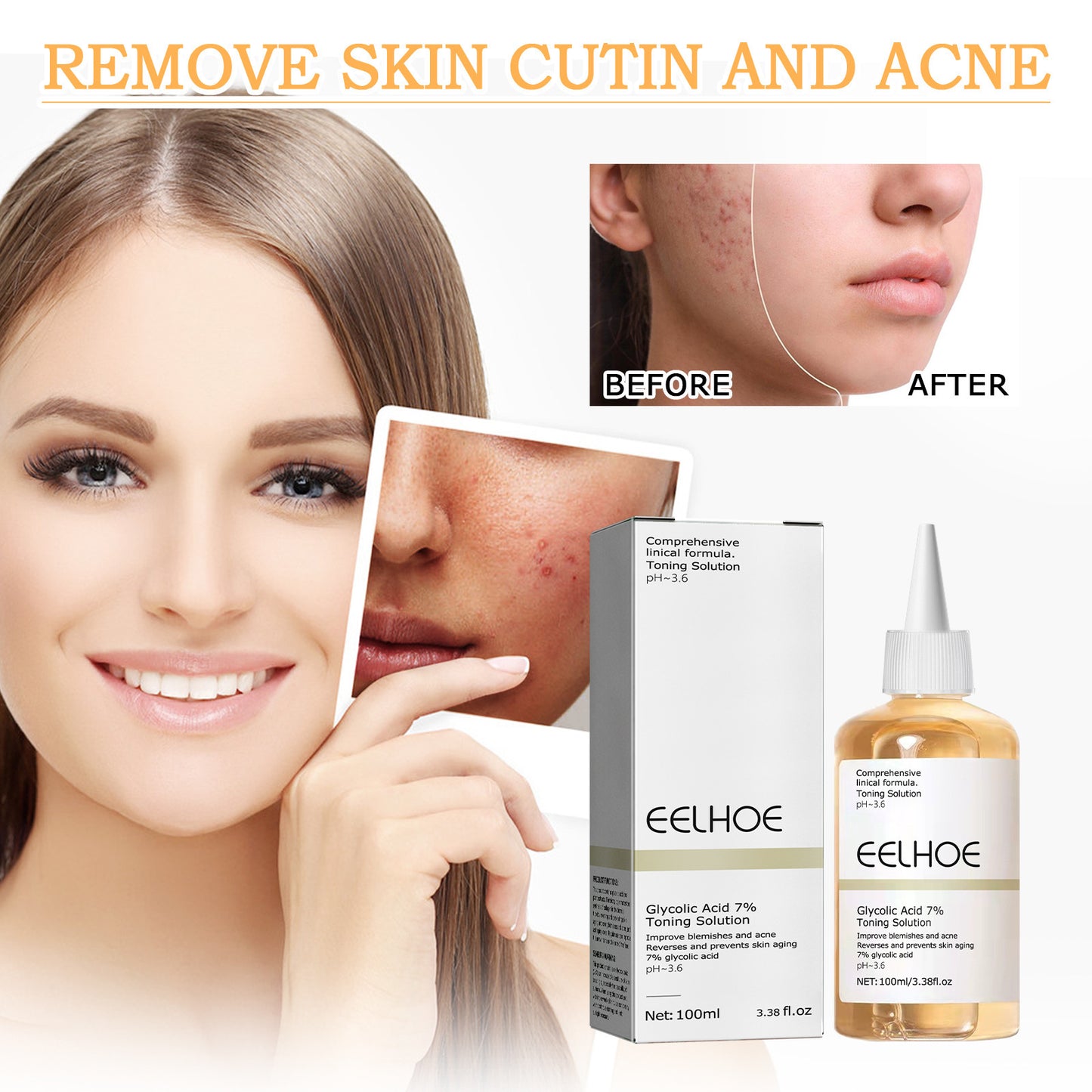 ClearGlow Glycolic Acid 7% Exfoliating Lotion – Acne & Texture Refining Toner (100ml)