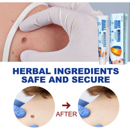 EELHOE Fragrance Removing Cream – Skin Repair & Wart Removal Treatment