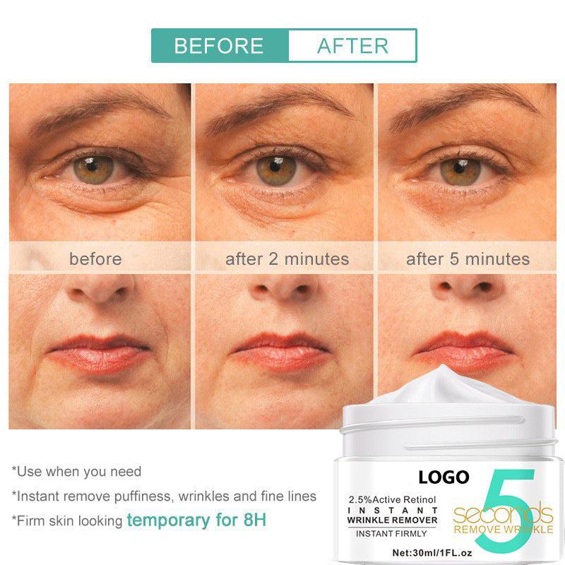 Retinol Moisturizing Cream – Smooth, Brighten & Restore Your Skin’s Natural Glow